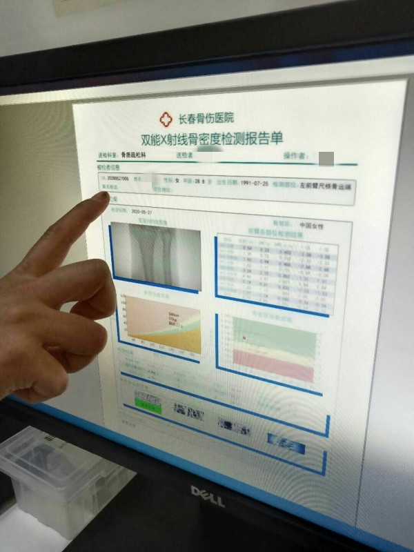 品源雙能X射線骨密度儀落戶吉林省長(zhǎng)春骨傷醫(yī)院，助力骨松診療