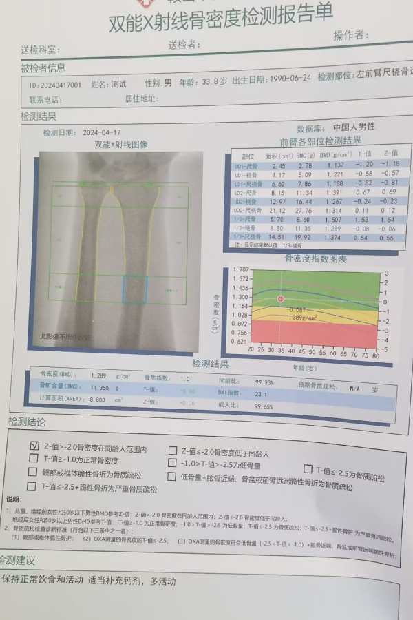 雙能X射線骨密度儀：準確測量骨密度，助力骨質(zhì)疏松防治，守護骨骼健康